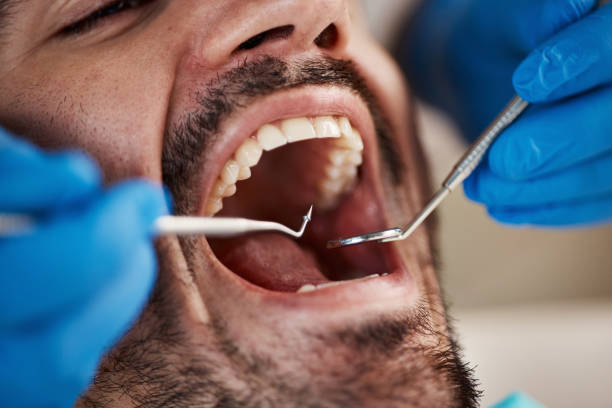 Best Cracked Tooth Emergency Dentist  in Sevierville, TN